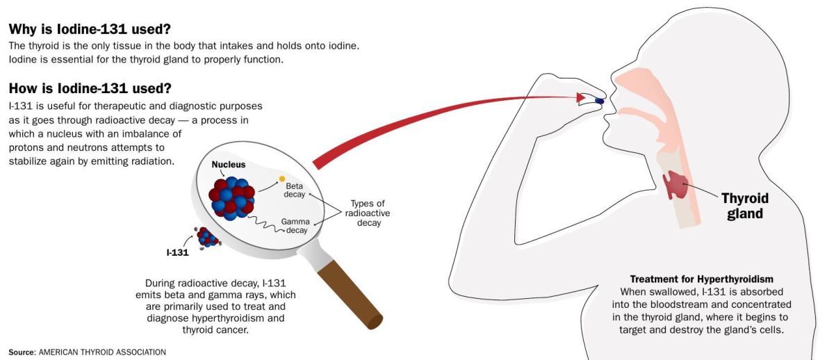 Iodine radioactive hals schwellung hypothyroidism ursachen divertikel zysten fisteln ultraschall organe bildet verschiedene